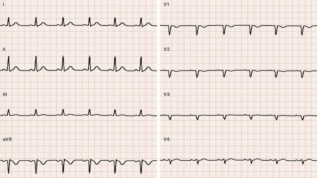 Einthoven Lab — educational 12-lead ECG simulator showing the limb and chest leads of a sinus tracing on ECG paper