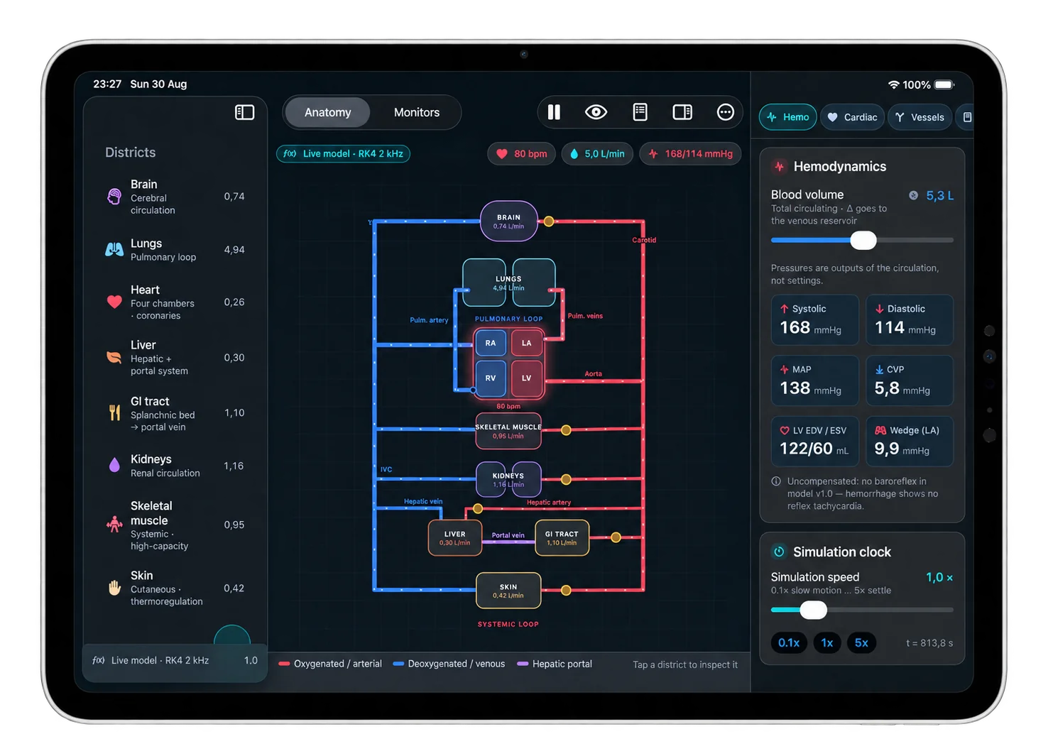 Starling Lab on iPad: the anatomical view of the whole circulation with per-district flows, beside the hemodynamics panel showing systolic, diastolic, MAP and CVP as model outputs