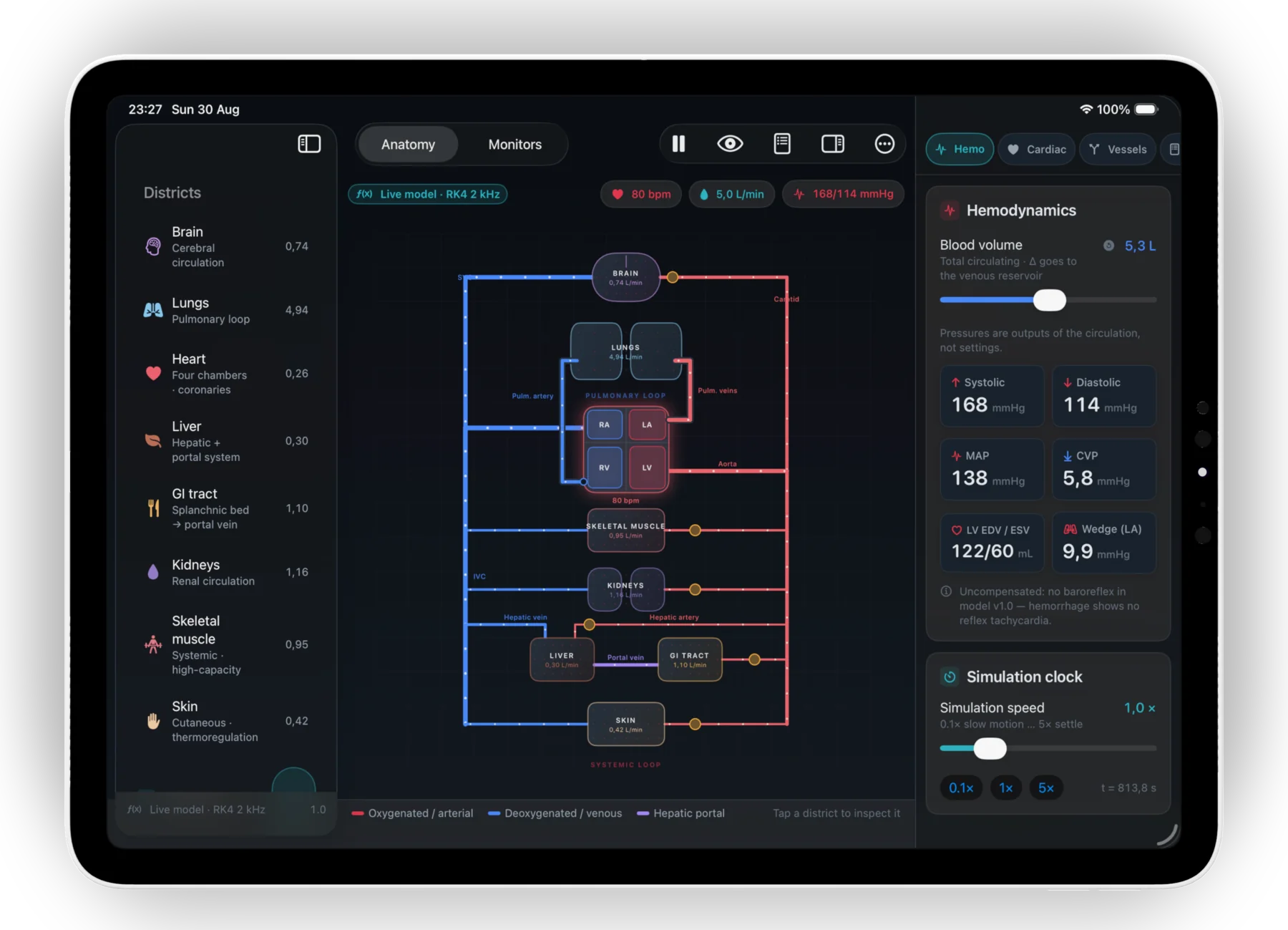 Starling Lab on iPad: the anatomical view of the whole circulation with per-district flows, beside the hemodynamics panel showing systolic, diastolic, MAP and CVP as model outputs