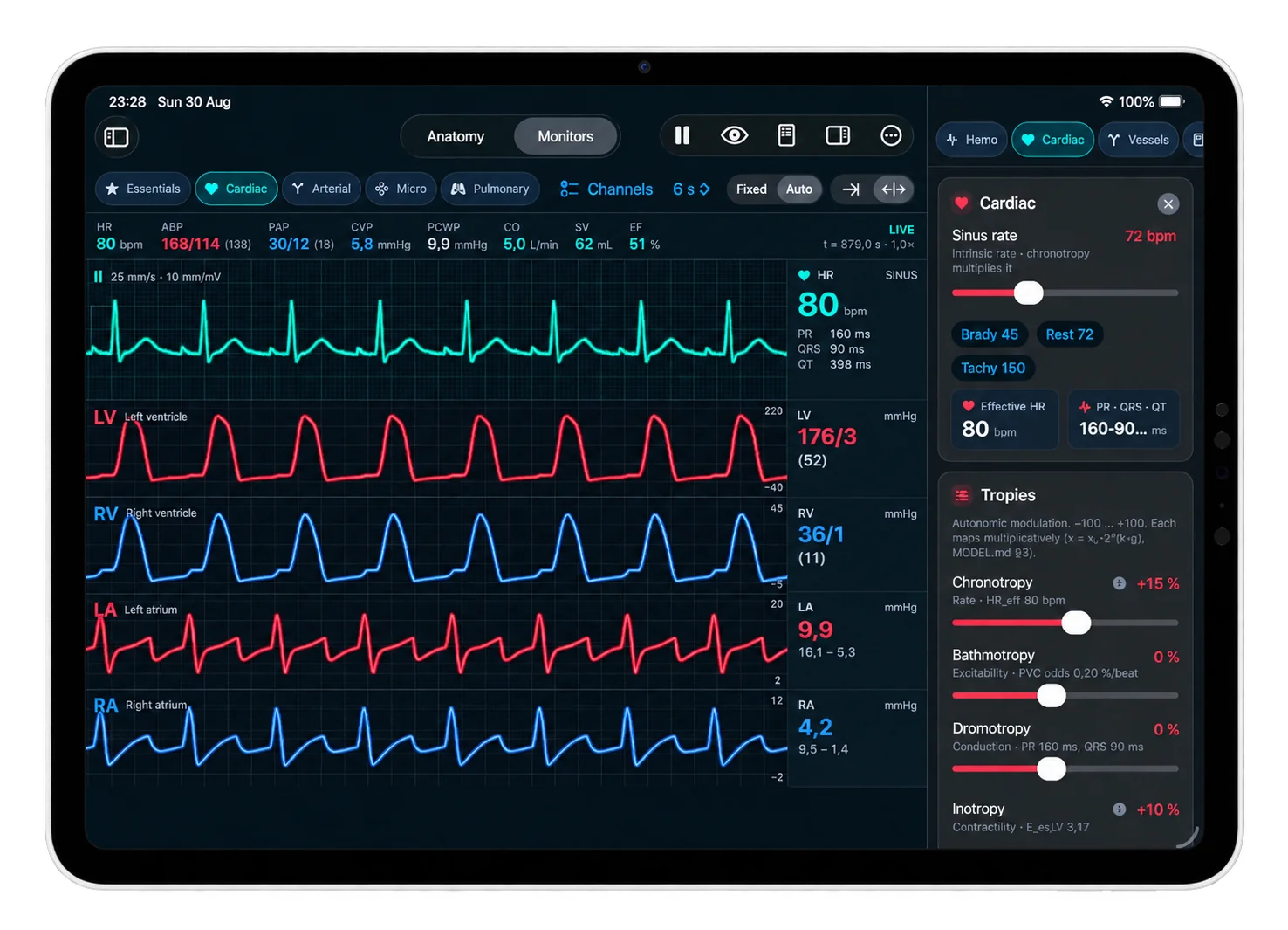 The Monitors view: a calibrated ECG strip with PR, QRS and QT readouts above left ventricle, right ventricle, left atrium and right atrium pressure traces, beside the Tropies control panel
