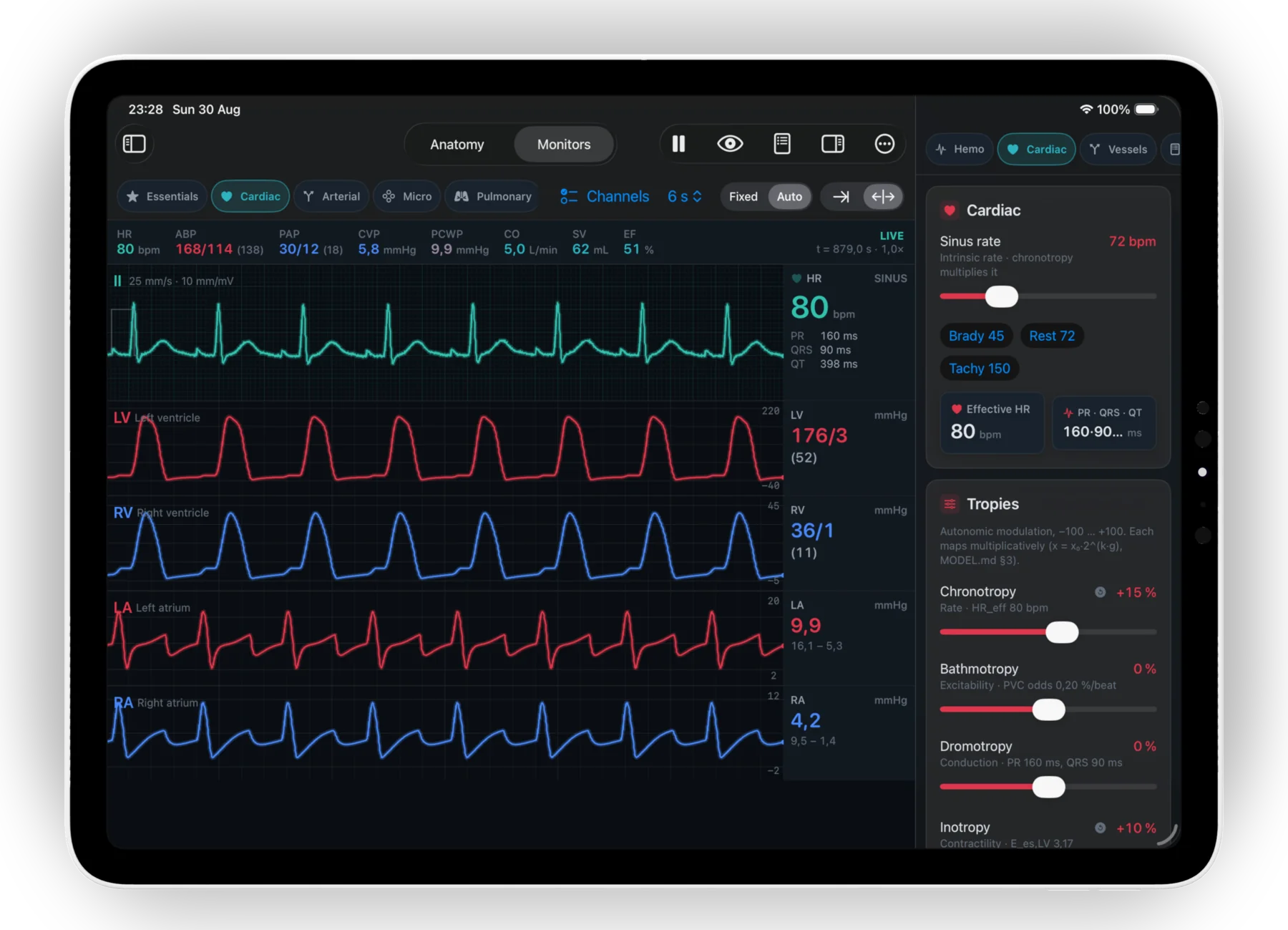 The Monitors view: a calibrated ECG strip with PR, QRS and QT readouts above left ventricle, right ventricle, left atrium and right atrium pressure traces, beside the Tropies control panel