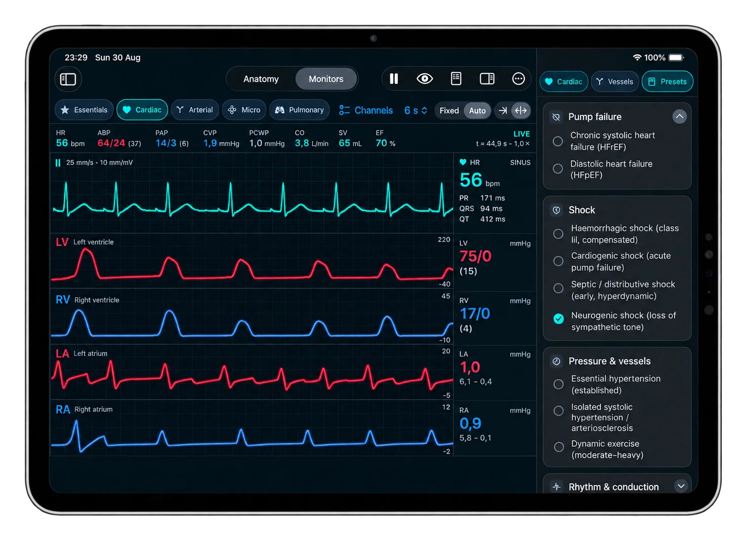 The teaching presets panel on iPad with neurogenic shock selected: the monitor shows a heart rate of 56, arterial pressure 61 over 24 and cardiac output 3.8 L/min