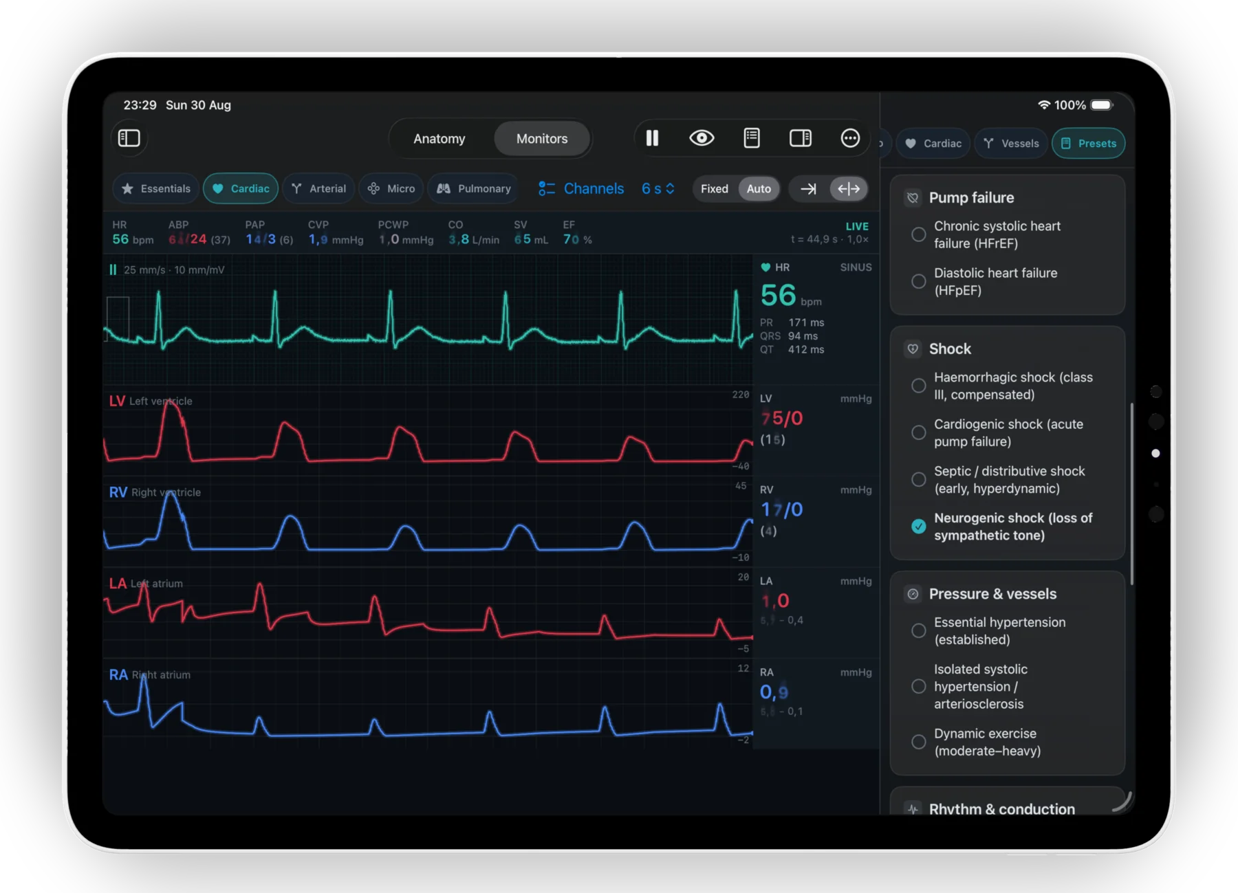 The teaching presets panel on iPad with neurogenic shock selected: the monitor shows a heart rate of 56, arterial pressure 61 over 24 and cardiac output 3.8 L/min