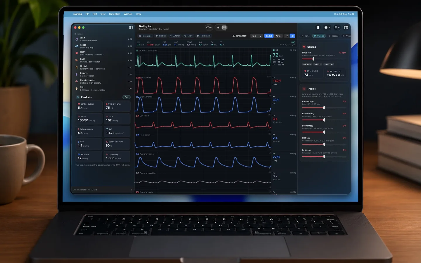 The Monitors view on a MacBook showing the ECG with left and right ventricular, atrial, pulmonary artery and pulmonary capillary pressure traces