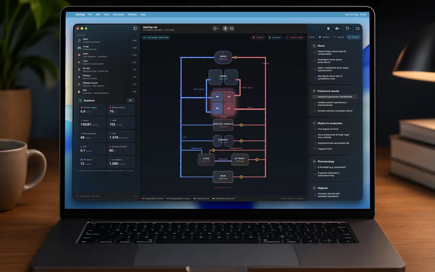 The teaching presets catalogue on a MacBook, listing shock, pressure and vessel, rhythm and conduction, pharmacology and regional scenarios